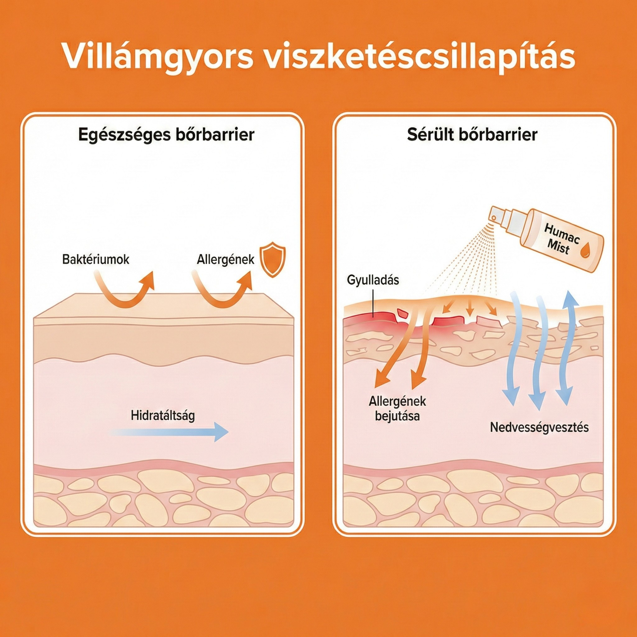 HUMAC® Mist 100 ml permet – egyetlen fújás a viszketés és irritált bőr ellen